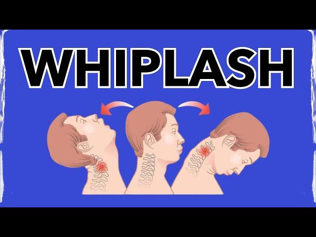 Whiplash: A Physical Therapy SECRET for Treating.