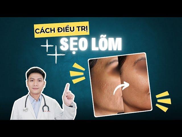 CÁCH ĐIỀU TRỊ SẸO RỖ HIỆU QUẢ | Bác sĩ Trường