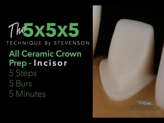 5x5x5 All Ceramic Incisor - Tooth Preparation for Maxillary Central Incisor