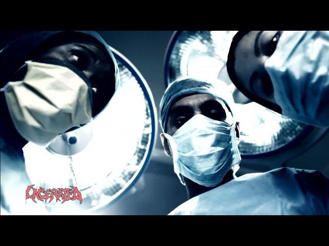 Lacerated - "Grotesque" (Official Video)