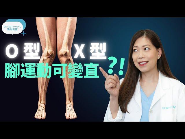 脊醫王鳳恩 -O型腳X型腳 , 運動可變直? (中/Eng Sub)-Leg exercises can improve Bowknee and Knock Knee - Dr Matty Wong