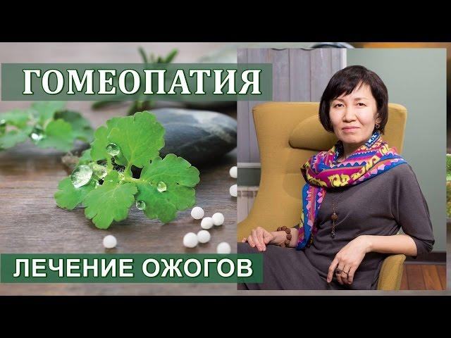 О Гомеопатии. Лечение ожогов гомеопатическими препаратами.