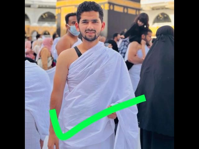 amir trt before and after life|#shorts#video#viral