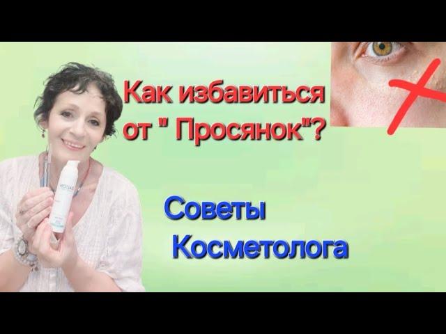 КАК ИЗБАВИТЬСЯ ОТ " ПРОСЯНОК"? Советы Косметолога.