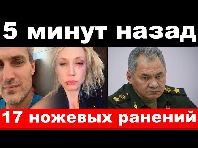 ранен Галкин, пожар у Шойгу, трагедия Орбакайте,,новости.