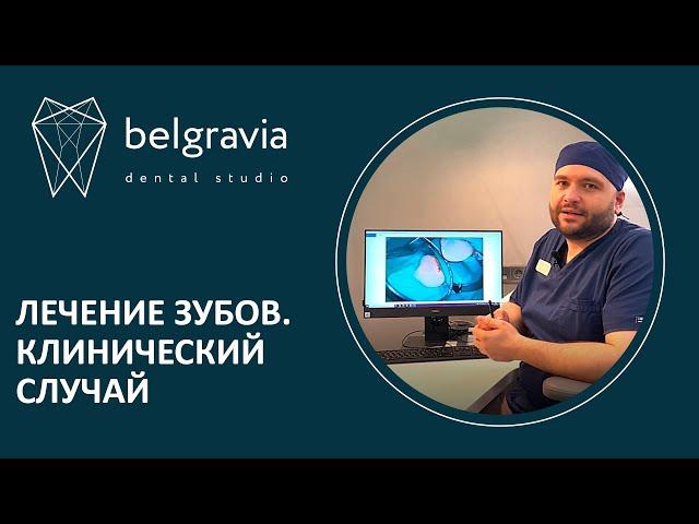  Лечение зубов. Клинический случай лечения пациента в Belgravia Dental Studio