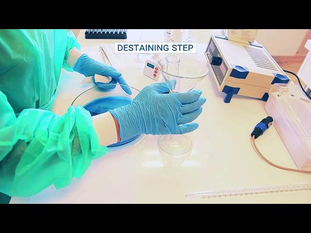 Serum protein electrophoresis