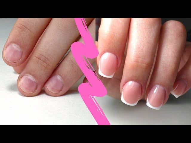 Incredible Nail Transformation | French Manicure | How to do a French tip Manicure