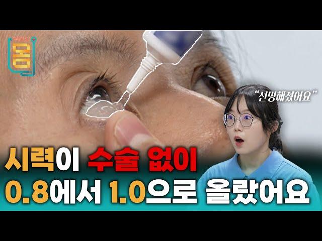 [Full] 시력이 수술 없이 0,8에서 1.0으로 올랐어요!ㅣ귀하신 몸ㅣ76화 안 보이는 눈, 고쳐드립니다