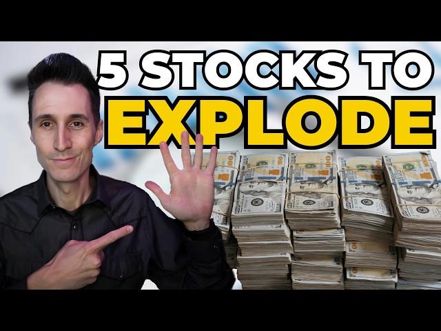 Top 5 Stocks To Buy NOW