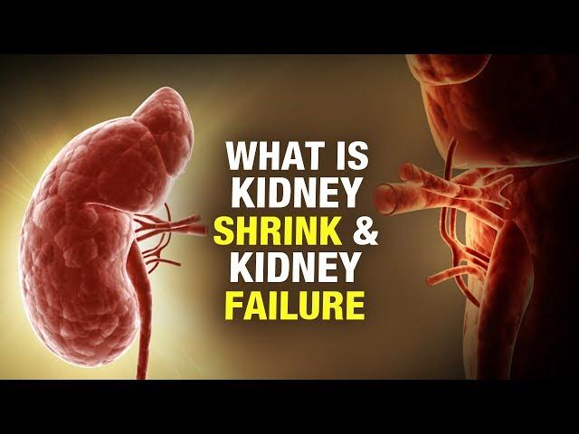 What isKidney Shrink & Kidney Failure? - Dr. Puneet Dhawan - Karma Ayurveda