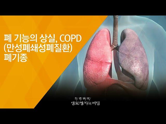 폐 기능의 상실, COPD(만성폐쇄성폐질환) 폐기종 - (2018.6.20_651회 방송) 기침과 호흡 곤란을 잡아라, 숨통이 트인다