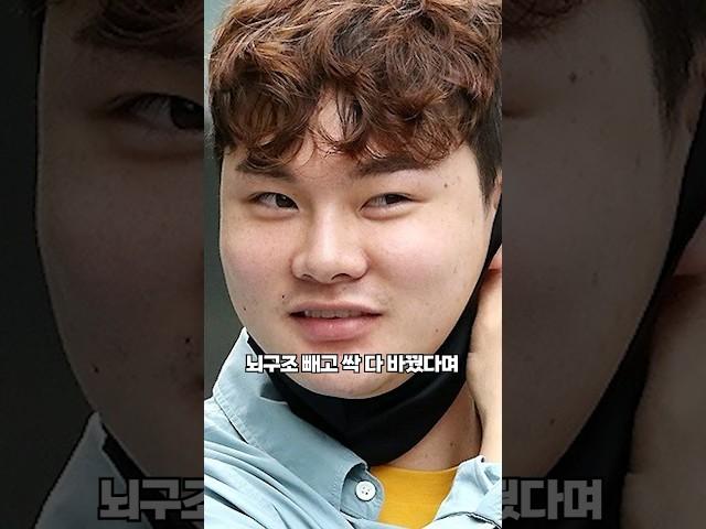 박서진 얼굴성형에 1억 지출 뇌빼고 다 바꿔