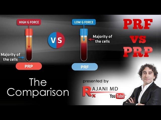 PRF vs PRP We Compare