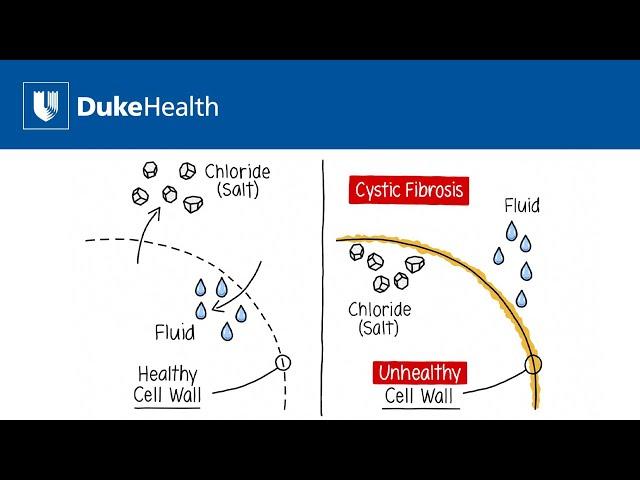 What is Cystic Fibrosis? | Duke Health