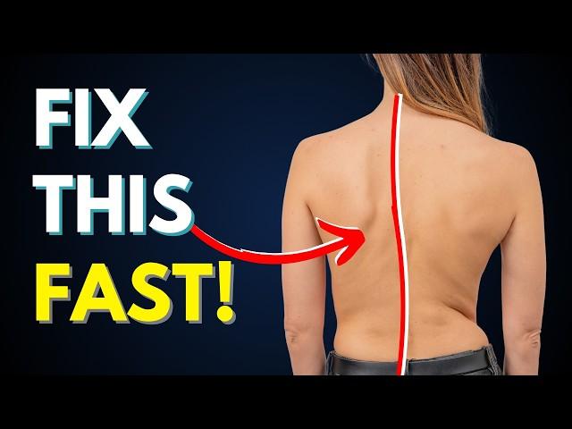 How To Treat Scoliosis (& Other Posture Issues)