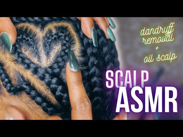 ASMR | real person scalp, scratching, dandruff removal + oiling | BLACK GIRL BRAIDS EDITION*