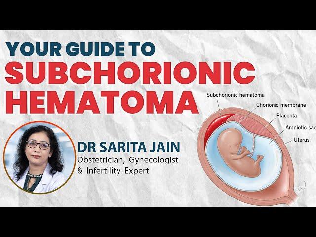 Your Guide To Subchorionic Hematoma  | Dr Sarita Jain | Arihant IVF