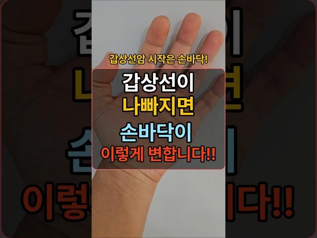 갑상선이 망가지면 손바닥이 이렇게 변합니다! #건강정보 #건강한중년 #장수의비밀 #중년건강 #50대건강 #건강상식 #건강 #지식 #건강관리