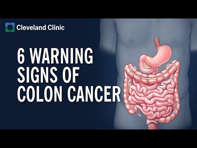 6 Warning Signs of Colon Cancer