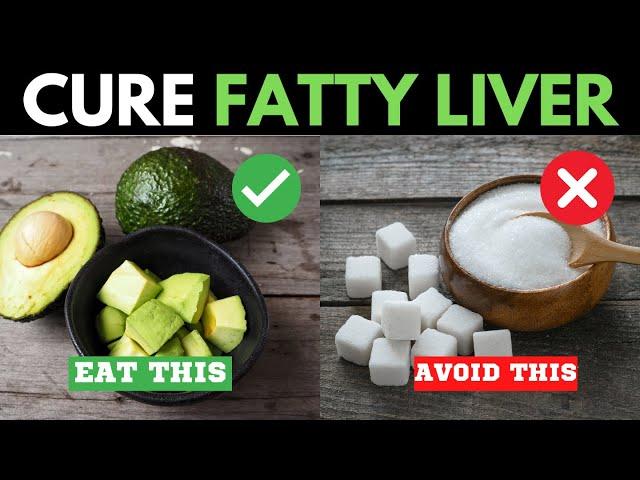 12 Best Foods To Cure Fatty Liver Fast