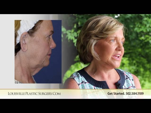 Facelift  necklift tummy tuck denise choosing Dr  O'daniel