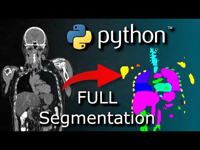 Python AI Organ Segmentation Tutorial