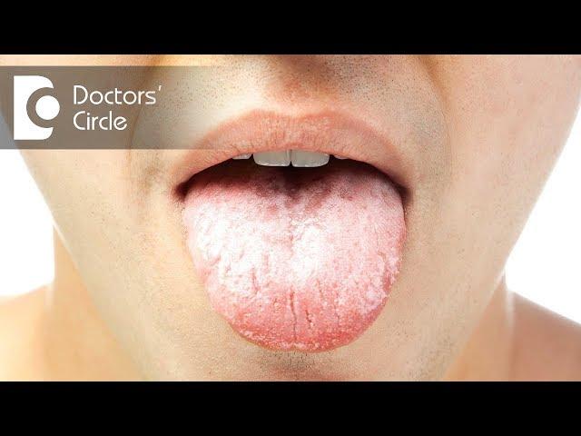 What does a white tongue in the morning mean? - Dr. Srivats Bharadwaj