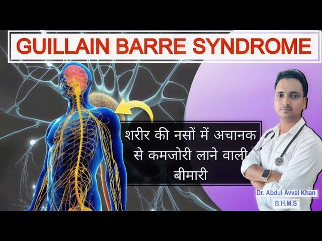 Guillain Barre Syndrome| gbs | guillain barre syndrome treatment homeopathy | #guillainbarresyndrome