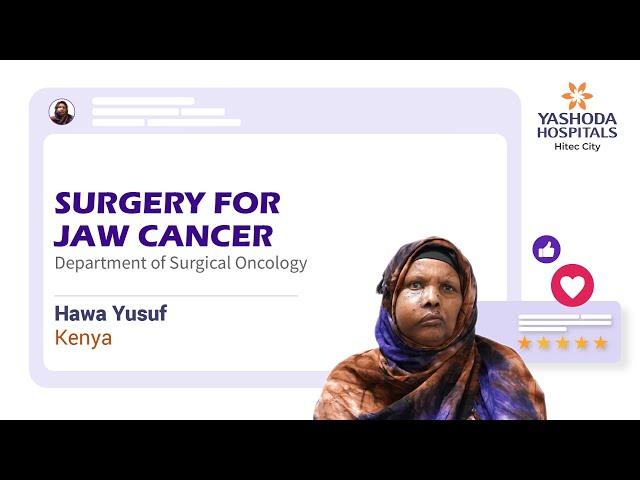 Surgery for Jaw Cancer (Right Jaw) | Surgery for Maxillae Carcinoma (Right Maxillae)