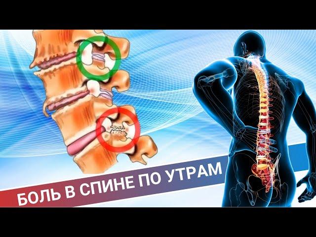 ТЯЖЕЛО УТРОМ ВСТАТЬ || БОЛИТ СПИНА