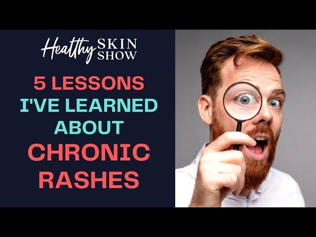 5 THINGS You Need To Know About Skin Rashes | Jennifer Fugo