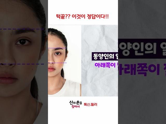 턱끝 이것이 정답이다!!  #동안얼굴만들기 #동안얼굴시술 #연예인얼굴시술