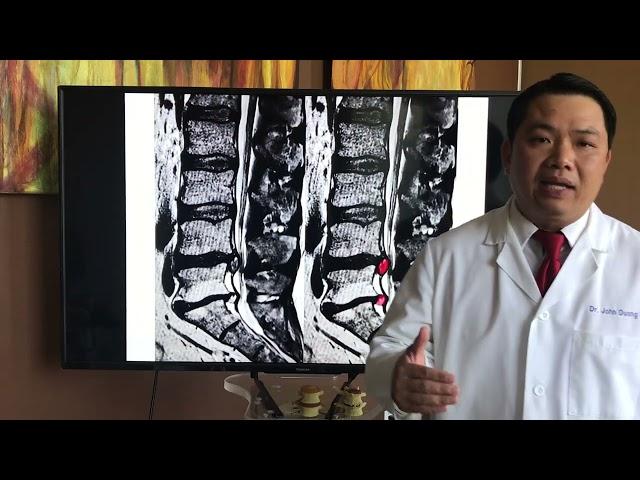 Dr. John Duong - Lower Back Pain