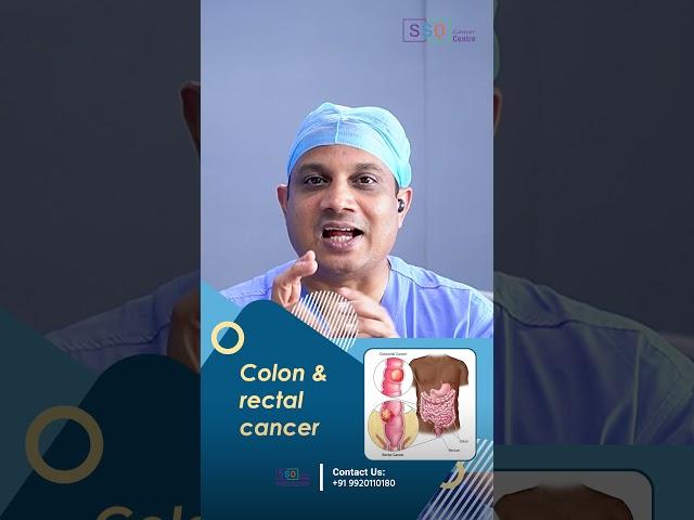 How Is Colon Cancer Treated? | Insights from Dr Nilesh chordiya, SSO