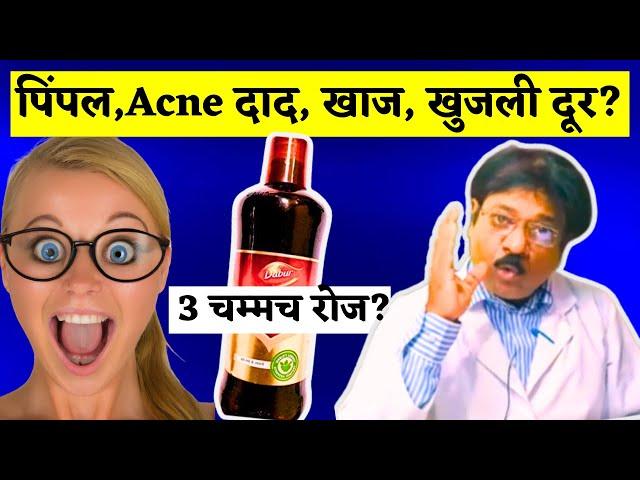 पिंपल्स और एक्ने का BEST इलाज- Khadirarishta | Dabur Khadiraristhta Syrup ke Fayde | डाबर खदिरारिष्ट