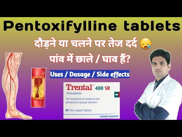 Trental 400 mg tablet | Trental 400 mg | Pentoxifylline tablets | Pentoxifylline uses