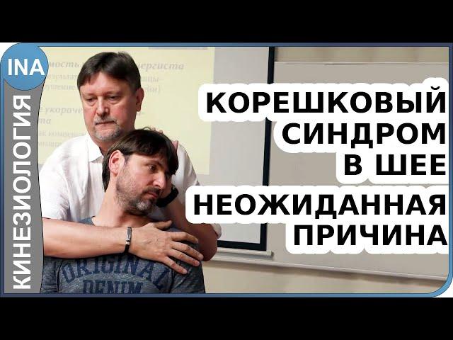 Корешковый синдром в шее. Неожиданная причина. Прикладная кинезиология