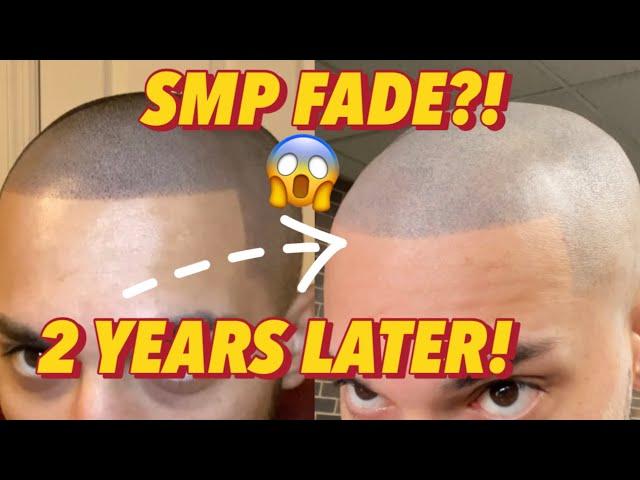 SMP 2 YEARS LATER! 4th Session! Permanent FADE?! (Scalp Micropigmentation)