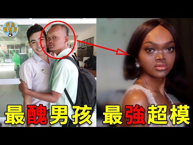 男孩因太醜被嘲笑，整容變性後逆襲成超模，火遍全球揚眉吐氣｜整容｜變性｜明星觀察員