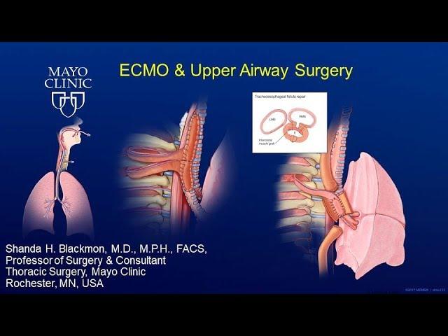 Blackmon ECMO and TEF Repair