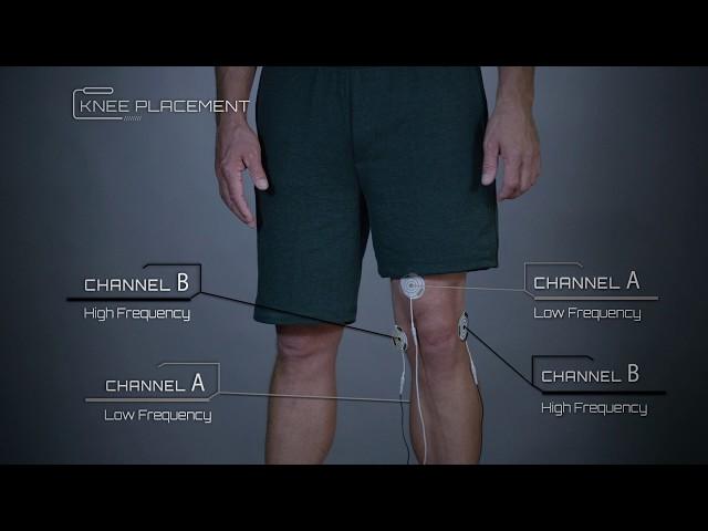 Knee Placement Example