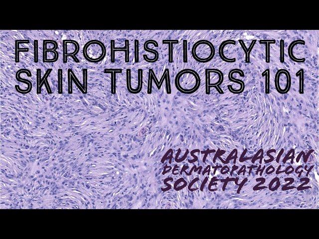 Fibrohistiocytic Skin Tumors 101 (Australasian Dermatopathology Society 2022 meeting) pathology