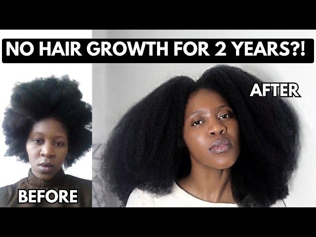 How to get UNSTUCK on your HAIR GROWTH JOURNEY | Natural Hair | South African Journey