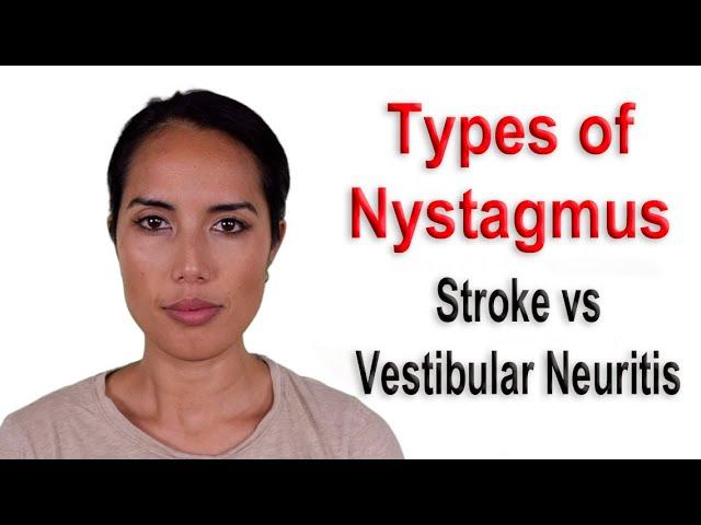 Types of Nystagmus Due to Stroke vs Vestibular Neuritis Causing Persistent Dizziness or Vertigo