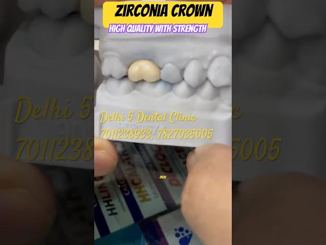 All ceramic ‼️ Dentcare Zirconia crown | Delhi 5 dental clinic | best dentist in delhi