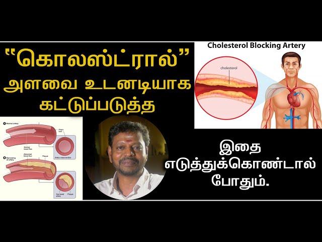 Cholesterol cntrl | கொலஸ்ட்ரால் அளவை உடனடியாக கட்டுக்குள் கொண்டு வர#health @Sadhgurusaicreations