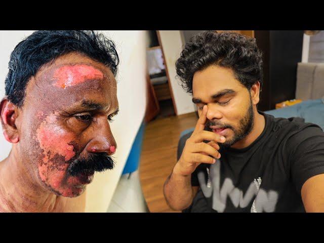 അച്ഛന്റെ ഇപ്പോളത്തെ അവസ്ഥ  EVERYBODY BE CAREFUL
