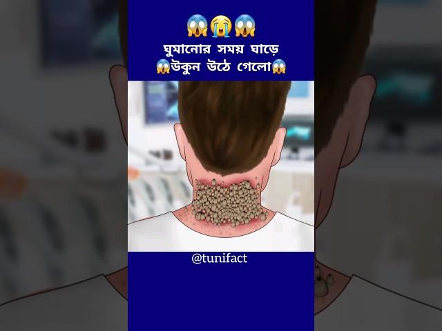 ঘুমানোর সময় ঘাড়ে উকুন উঠে গেলো #cartoon