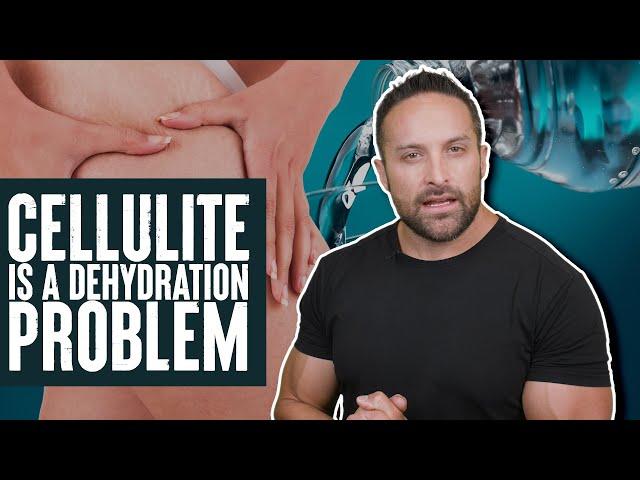 Cellulite is a Dehydration Problem! | What the Fitness | Biolayne